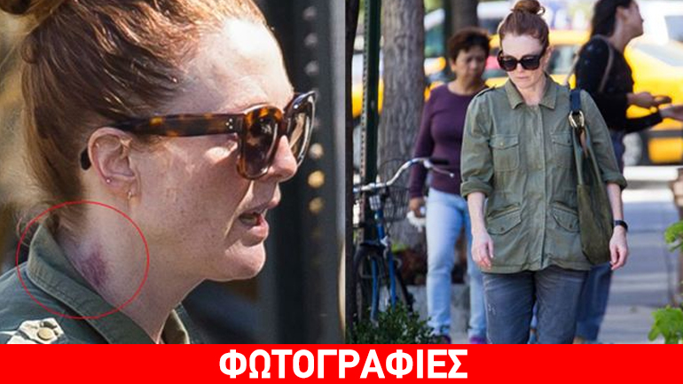 Julianne Moore: Με κόκκινο σημάδι στο λαιμό που «έβγαζε μάτι» σε πρωινή της έξοδο!